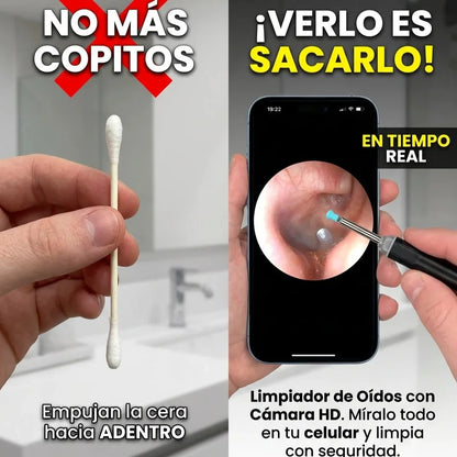 Limpiador de Oídos con Cámara Integrada