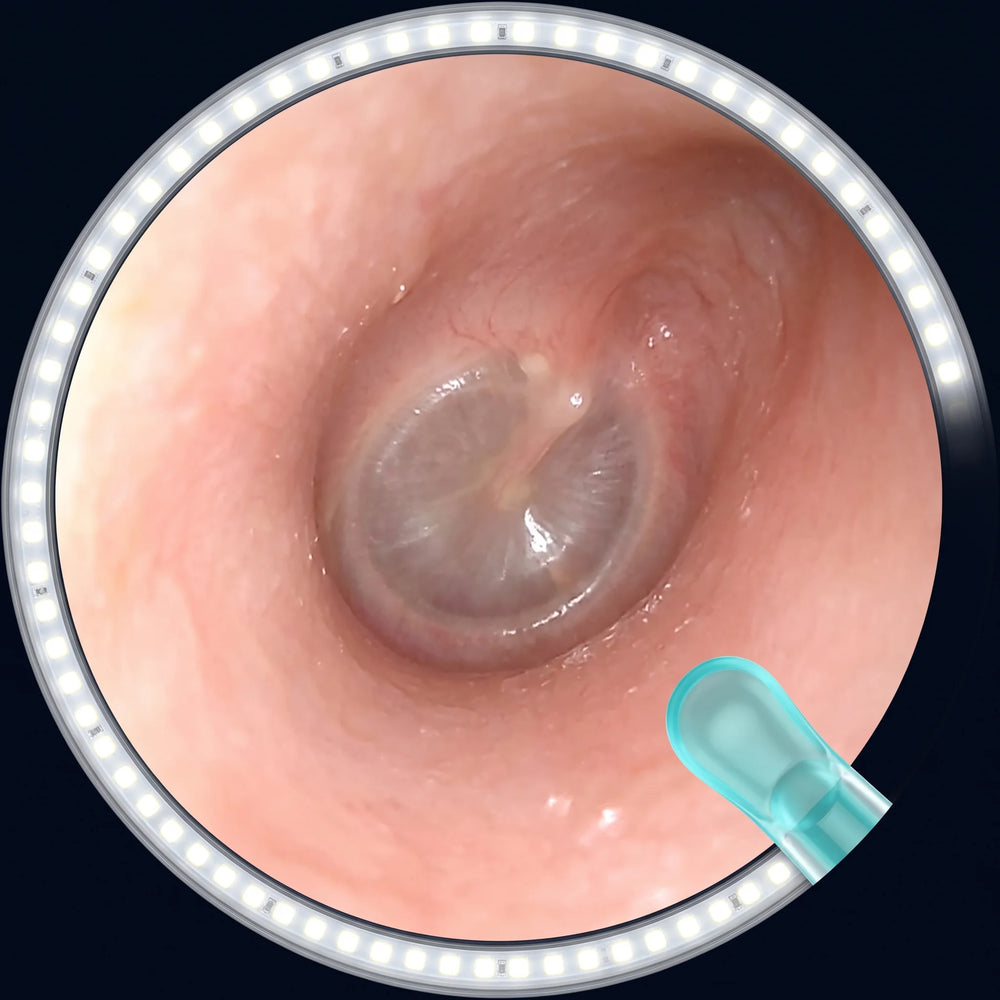 Endoscopic view of human ear